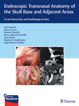 Hardcover Endoscopic Transnasal Anatomy of the Skull Base and Adjacent Areas: A Lab Dissection and Radiological Atlas Book