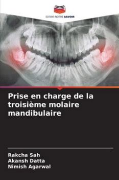 Prise en charge de la troisième molaire mandibulaire (French Edition)