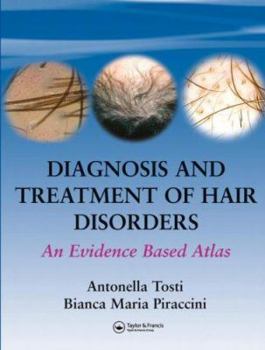 Hardcover Diagnosis and Treatment of Hair Disorders: An Evidence-Based Atlas Book