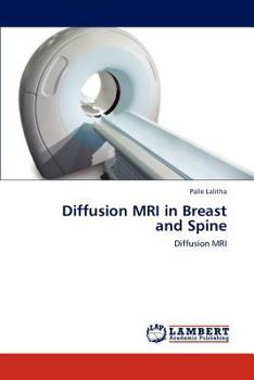 Paperback Diffusion MRI in Breast and Spine Book
