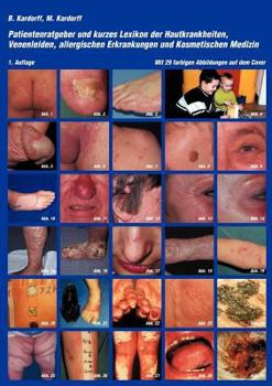 Paperback Patientenratgeber und kurzes Lexikon der Hautkrankheiten, Venenleiden, allergischen Erkrankungen und kosmetischen Medizin [German] Book