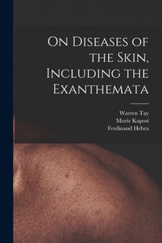 On Diseases of the Skin, Including the Exanthemata