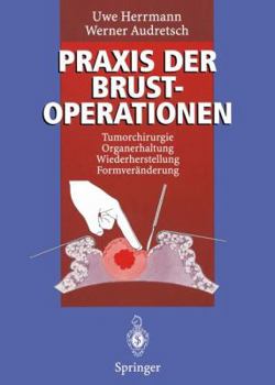 Paperback PRAXIS Der Brustoperationen: Tumorchirurgie -- Organerhaltung -- Wiederherstellung -- Formveränderung [German] Book