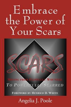 Embrace the Power of Your Scars: Moving from Painfully Wounded to Powerfully Scarred