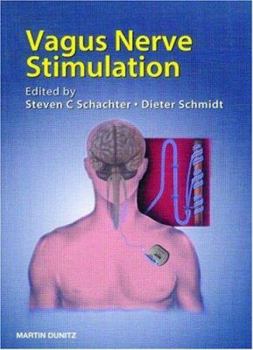 Paperback Vagus Nerve Stimulation [With CDROM] Book