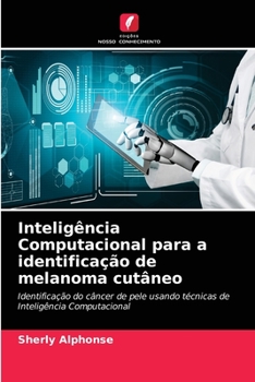 Paperback Inteligência Computacional para a identificação de melanoma cutâneo [Portuguese] Book