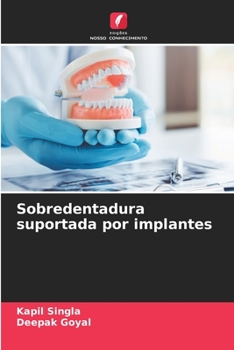 Paperback Sobredentadura suportada por implantes [Portuguese] Book