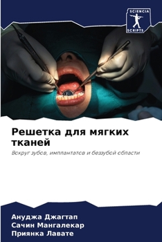 Paperback &#1056;&#1077;&#1096;&#1077;&#1090;&#1082;&#1072; &#1076;&#1083;&#1103; &#1084;&#1103;&#1075;&#1082;&#1080;&#1093; &#1090;&#1082;&#1072;&#1085;&#1077; [Russian] Book