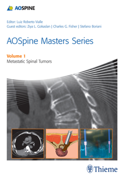 Hardcover Aospine Masters Series Volume 1: Metastatic Spinal Tumors Book