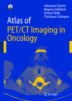 Hardcover Atlas of Pet/CT Imaging in Oncology Book