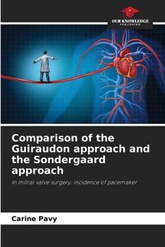 Paperback Comparison of the Guiraudon approach and the Sondergaard approach Book