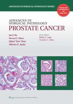 Hardcover Advances in Surgical Pathology: Prostate Cancer Book