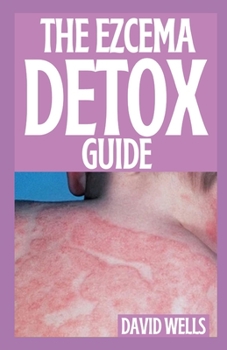 Paperback The Ezcema Detox Guide: How to Stop and Prevent The Itch of Eczema Through Diet and Nutrition Book