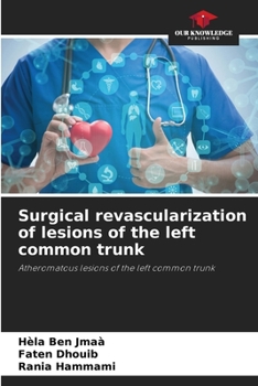 Paperback Surgical revascularization of lesions of the left common trunk Book