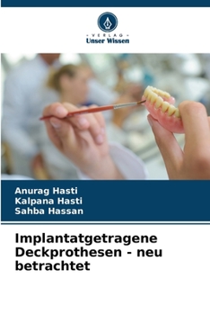 Paperback Implantatgetragene Deckprothesen - neu betrachtet [German] Book