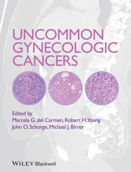 Hardcover Uncommon Gynecologic Cancers Book