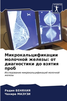 Paperback Микрокальцификации мол&# [Russian] Book