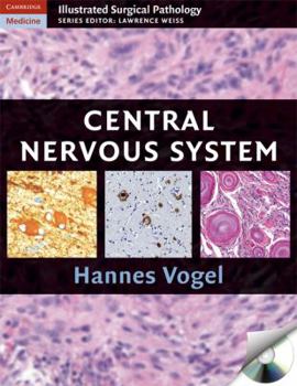 Nervous System - Book  of the Cambridge Illustrated Surgical Pathology
