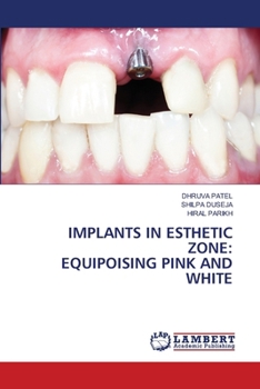Paperback Implants in Esthetic Zone: Equipoising Pink and White Book