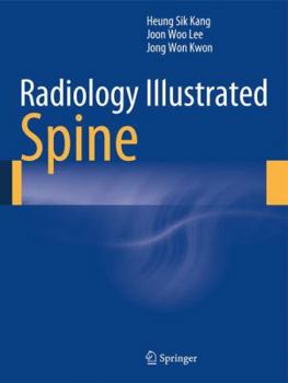Hardcover Radiology Illustrated: Spine Book