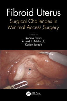 Hardcover Fibroid Uterus: Surgical Challenges in Minimal Access Surgery Book