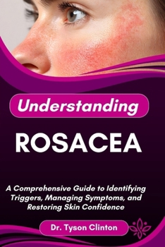 Paperback Understanding Rosacea: A Comprehensive Guide to Identifying Triggers, Managing Symptoms, and Restoring Skin Confidence Book