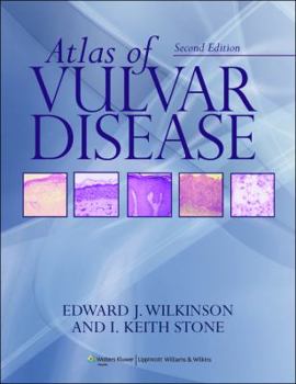 Hardcover Atlas of Vulvar Disease Book