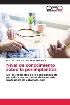 Paperback Nivel de conocimiento sobre la periimplantitis [Spanish] Book