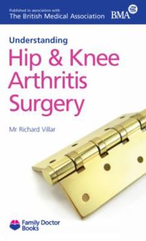 Paperback Understanding Hip & Knee Arthritis Surgery (Family Doctor Books) Book