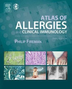Hardcover Atlas of Allergies and Clinical Immunology: Textbook with CD-ROM Book