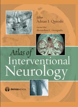 Hardcover Atlas of Interventional Neurology Book