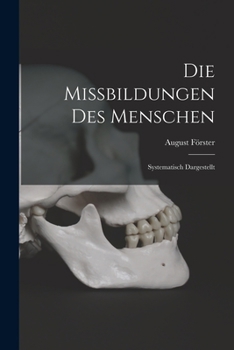 Paperback Die Missbildungen Des Menschen: Systematisch Dargestellt [German] Book
