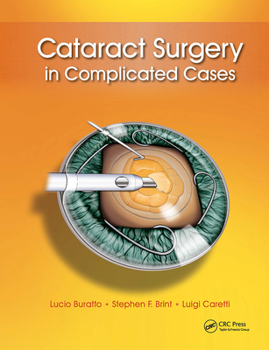 Hardcover Cataract Surgery in Complicated Cases Book