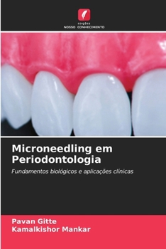 Paperback Microneedling em Periodontologia [Portuguese] Book