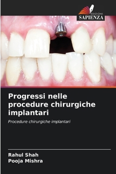 Paperback Progressi nelle procedure chirurgiche implantari [Italian] Book