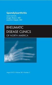 Hardcover Spondyloarthropathies, an Issue of Rheumatic Disease Clinics: Volume 38-3 Book