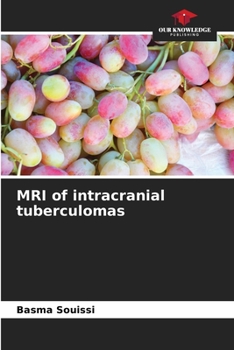 Paperback MRI of intracranial tuberculomas Book