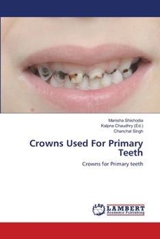 Paperback Crowns Used For Primary Teeth Book