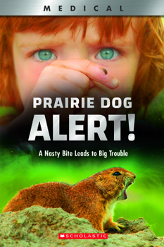 Prairie Dog Alert! (XBooks): A Nasty Bite Leads to Big Trouble - Book  of the XBooks Medical