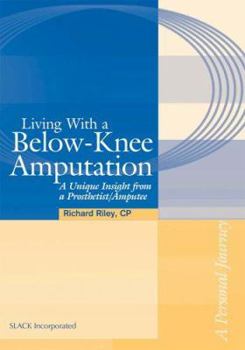 Paperback Living with a Below-Knee Amputation: A Unique Insight from a Prosthetist/Amputee Book