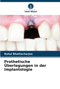 Paperback Prothetische Überlegungen in der Implantologie [German] Book