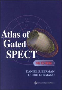 CD-ROM Atlas of Gated SPECT on CD-ROM (CD-ROM for Windows and Macintosh) Book