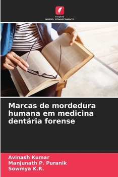 Paperback Marcas de mordedura humana em medicina dentária forense [Portuguese] Book