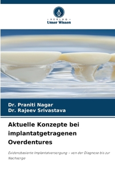Aktuelle Konzepte bei implantatgetragenen Overdentures (German Edition)