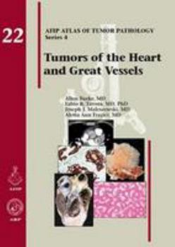 Hardcover Atlas of Tumor Pathology, 4th Series: Tumors of the Heart and Great Vessels Book