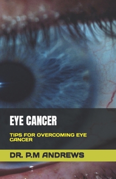 Paperback Eye Cancer: Tips for Overcoming Eye Cancer Book