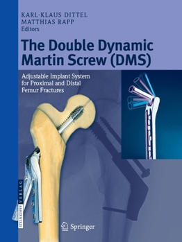 Paperback The Double Dynamic Martin Screw (DMS): Adjustable Implant System for Proximal and Distal Femur Fractures Book