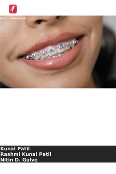 Paperback Redução interproximal do esmalte [Portuguese] Book