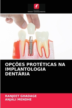 Paperback Opções Protéticas Na Implantologia Dentária [Portuguese] Book
