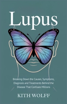 Lupus: Breaking Down the Causes, Symptoms, Diagnosis, and Treatments Behind the Disease That Confuses Millions